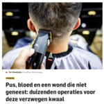 Sinus Pilonidalis in het nieuws